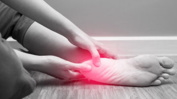 Plantar Fasciitis